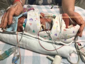 An infant in an incubator, wrapped up with medical instruments and two hands holding him.