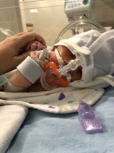 A hand holds in infant in an NICU bed, hooked up to many instruments and on a ventilator