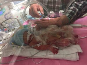 An infant in a hospital incubator wearing a blue hat. A man's hand is placed next to the infant to show how small the infant is.