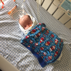 An infant attached to medical equipment and tubes sleeps peacefully in a hospital bed under a Christmas-themed blanket.