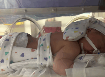 Maeve’s Whirlwind Rare Disease Journey: Pierre Robin Sequence
