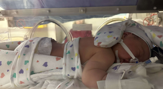 Maeve’s Whirlwind Rare Disease Journey: Pierre Robin Sequence