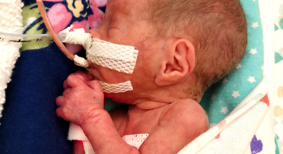 Petra’s First Breath of Hope: How One Tiny Fighter Found Her Way Home