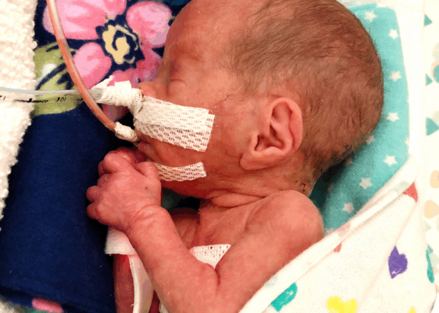 Petra’s First Breath of Hope: How One Tiny Fighter Found Her Way Home